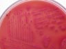 Agar colonies